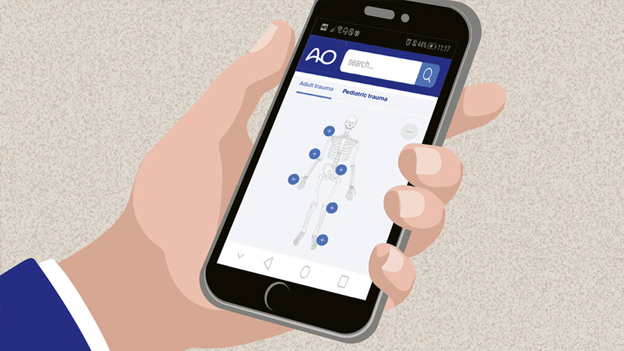 AO Surgery Reference