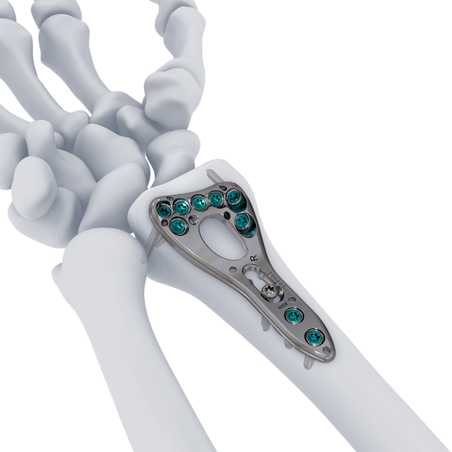 VOLT Wrist System
