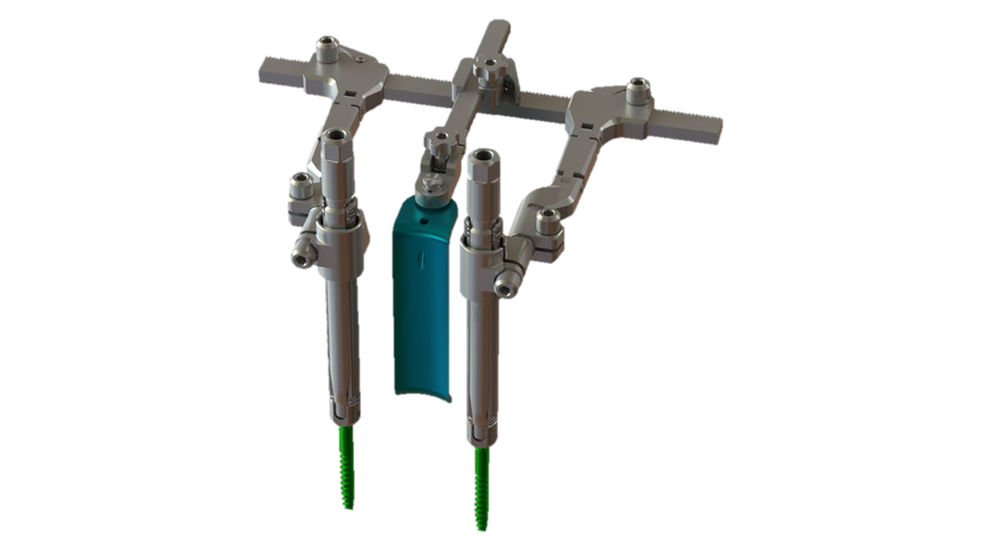 VIPER PRIME™ TLIF Retractor